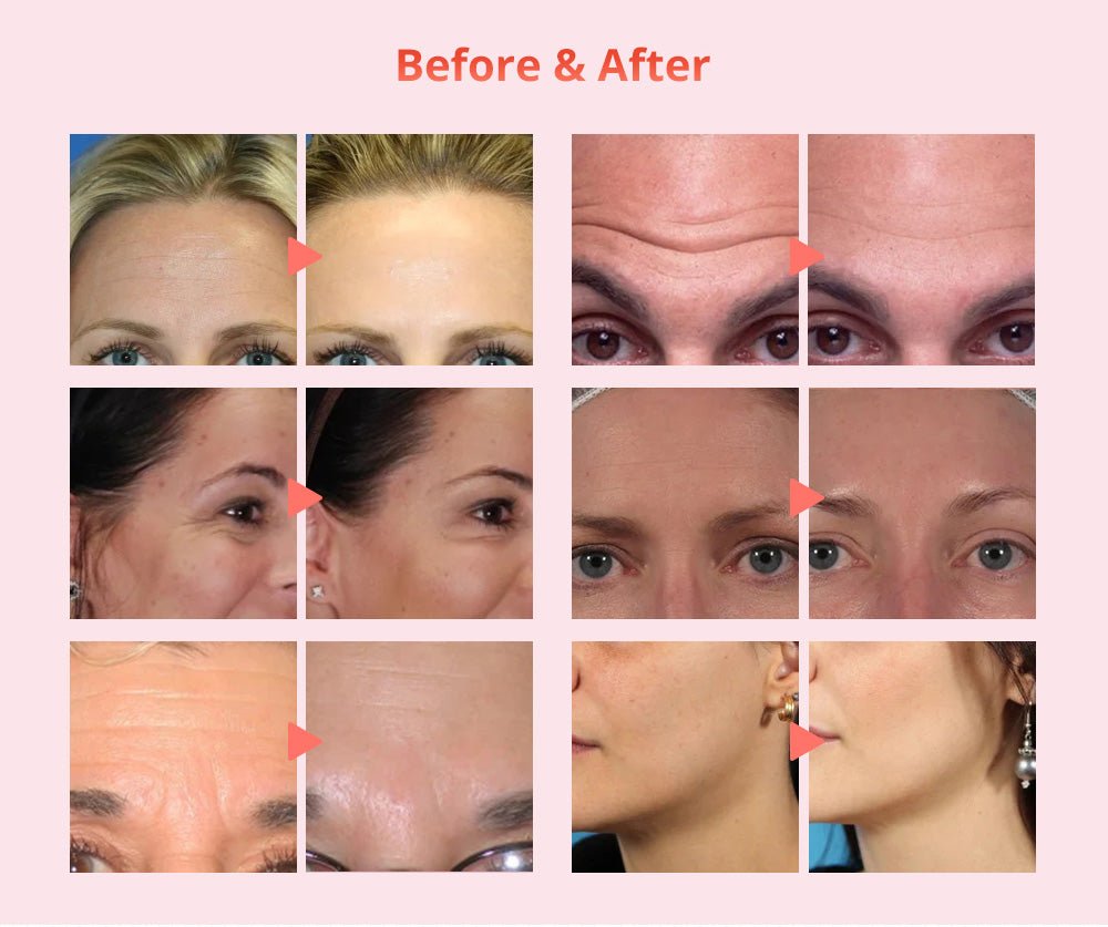 Shape Tactics Diamond Dermabrasion, Ultrasonic & RF Multi-Function Facial System