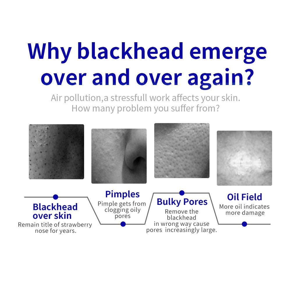 Shape Tactics Diamond Microdermabrasion & Vacuum Spray Facial Exfoliation System