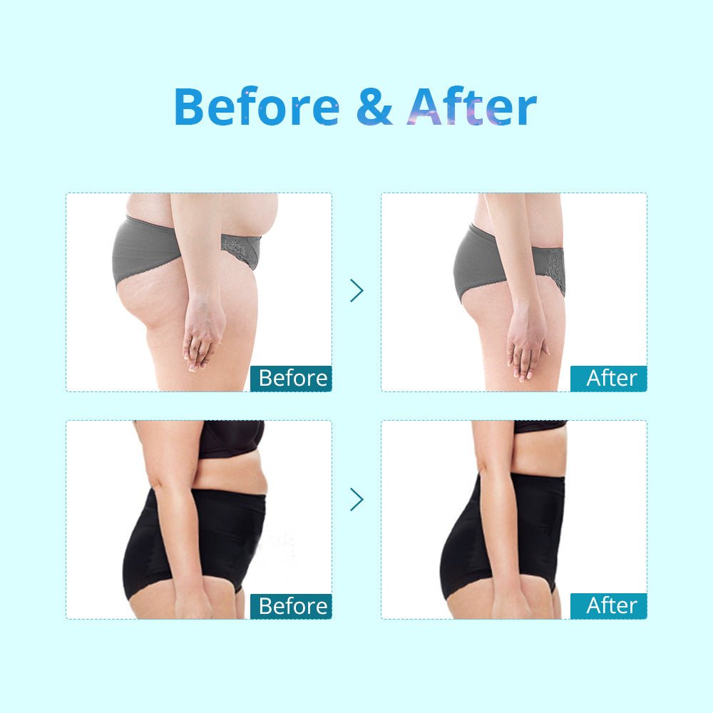 Shape Tactics Portable Dual-Handle Cryolipolysis Body Contouring System