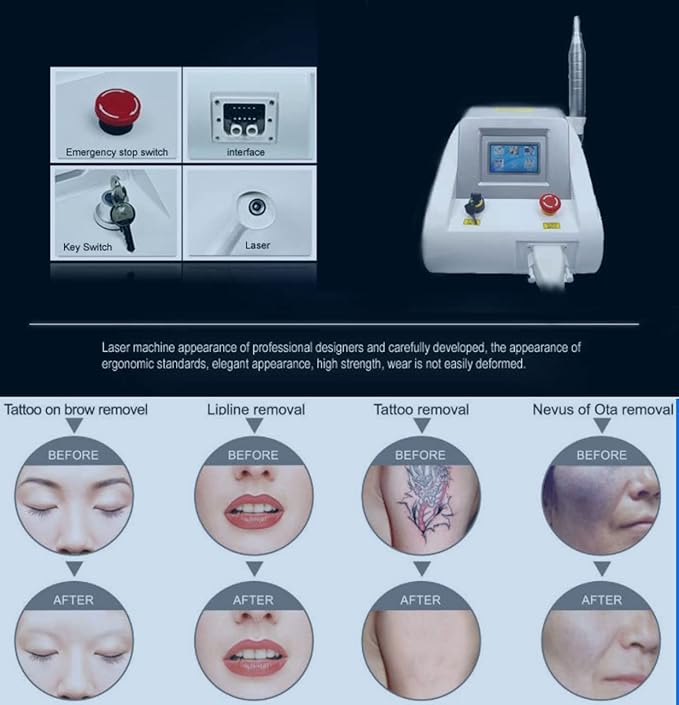 Shape Tactics Precision 3-Wavelength Picosecond Laser System