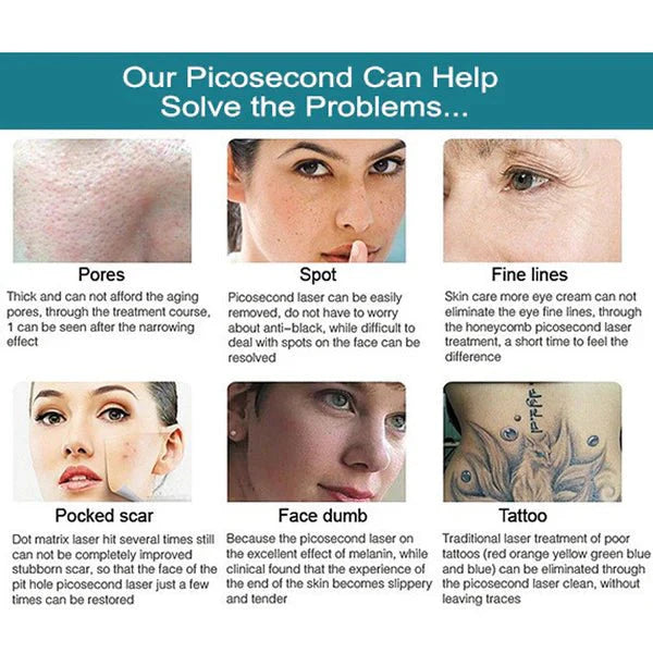 Shape Tactics Advanced 4-Wavelength Picosecond Laser System